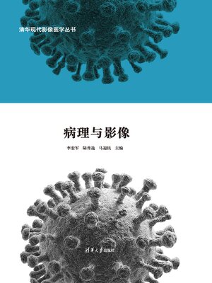 cover image of 冠状病毒家族肺炎病理与影像